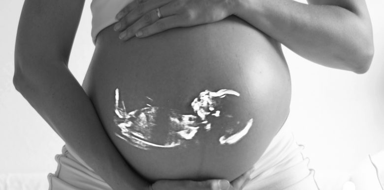 From Riverside hypnobirthing - birth: let's lose the fear